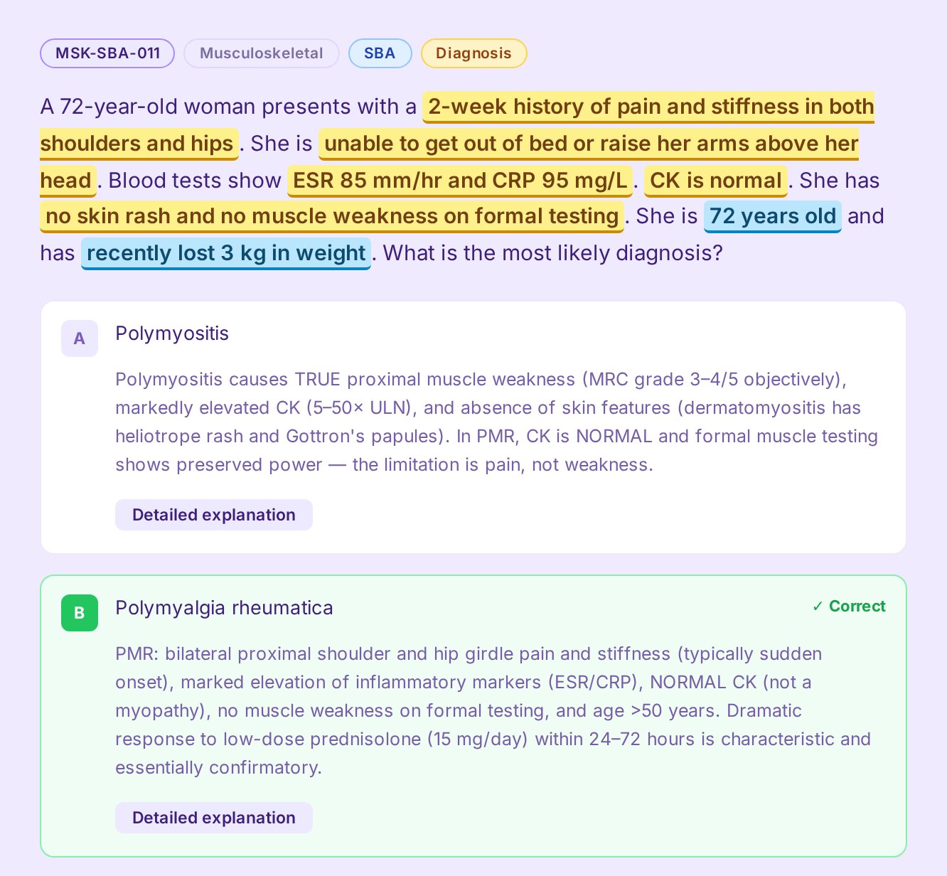 Ossify Tutor Mode after answering a question on polymyalgia rheumatica: the diagnostic clues in the question are highlighted in yellow, a distractor in blue, and each answer option has its own explanation, with the correct answer marked.